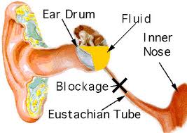 Infections of the Inner Ear
